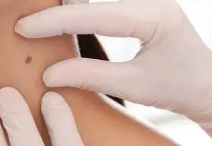 Skin check Southern Star Medical